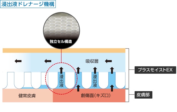 図）浸出液ドレナージ機構